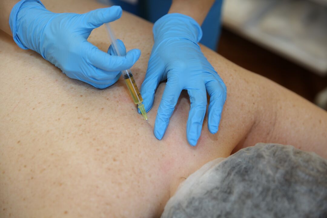 инжекции на хондропротектори за гърба